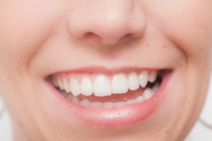 日本人の歯は平均どれくらい残っている？
